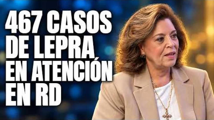 Emma Guzmán: 467 casos de lepra siguen en atención en el país