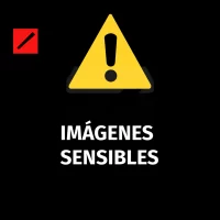 Varias personas quemadas tras explosión fuegos artificiales en carnaval de Salcedo