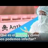 República Dominicana en alerta por posible ántrax. Pero ¿Qué es y cómo nos podemos infectar?