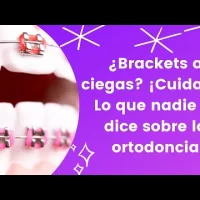 Antes de ponerte brackets… Esto tienes que saber según una especialista
